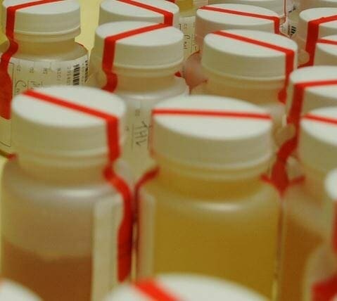 urine specimens