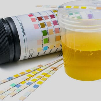 lab test strip