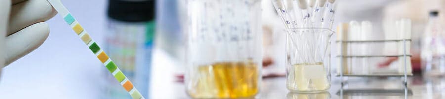 A scientist testing the urines