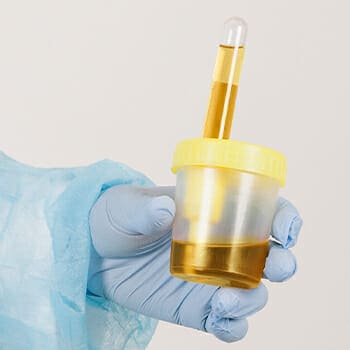 Synthetic urine being held by a professional