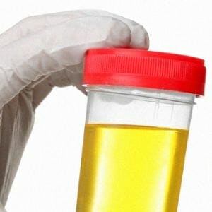 Close up image of synthetic urine sample