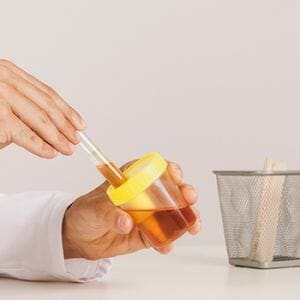 A urine sample for nicotine test