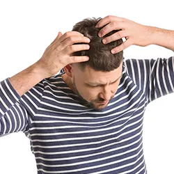 man showing his hair