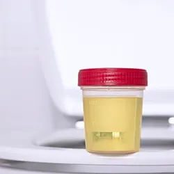 A jar filled with urine on top of a toilet