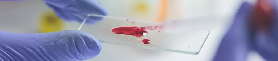 A doctor examining blood sample