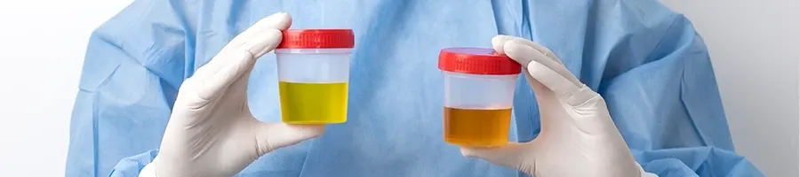 A person holding two different synthetic urines in a jar
