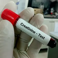 A test tube labeled creatinine