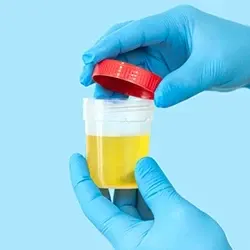 A person opening a jar filled with urine